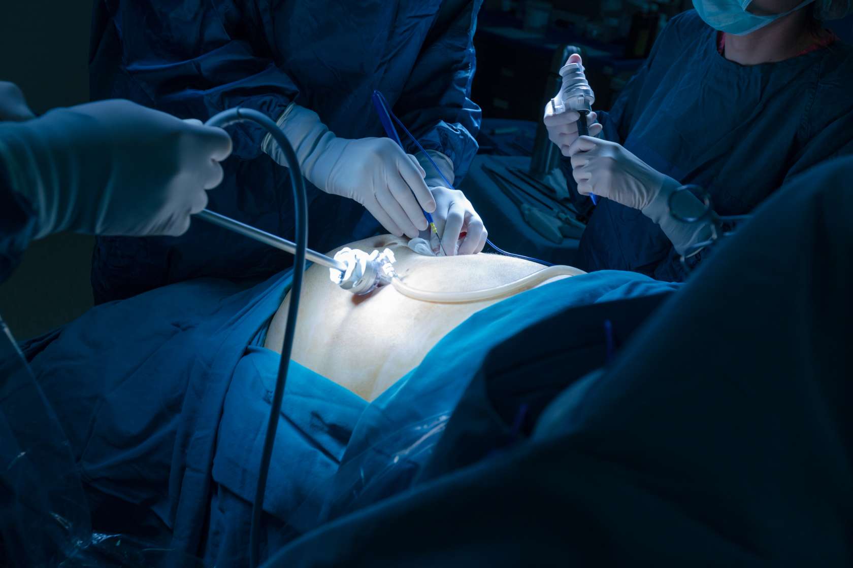 Spine Surgery