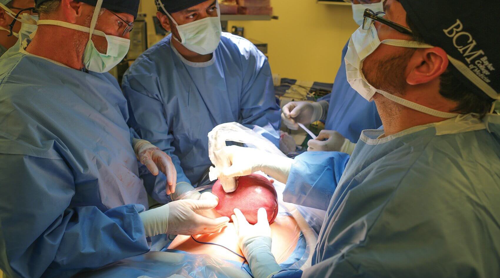 Fetal Ultrasound